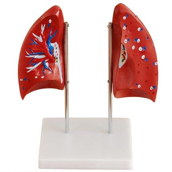 Akciğer Modeli 4 Parça
