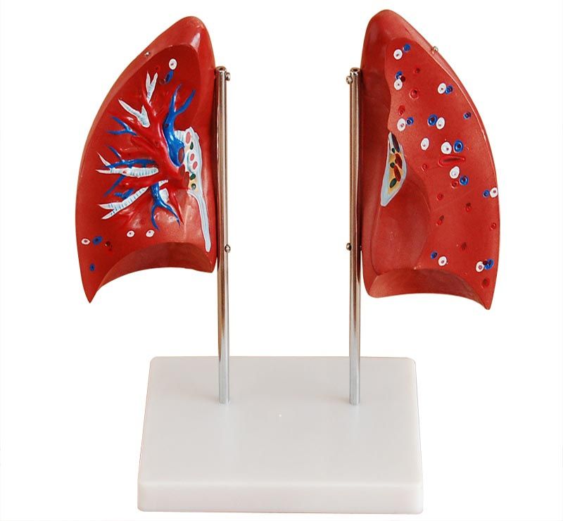 Akciğer Modeli 4 Parça